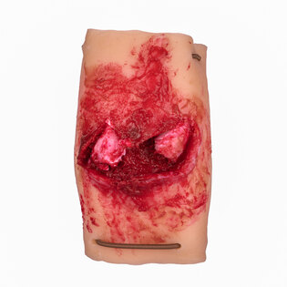 Alkar törésének szimulátora TactiFlesh®